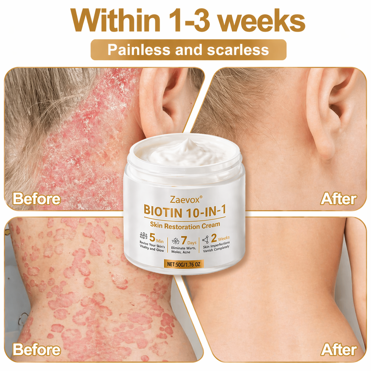 Made and Shipped from USA ✨Zaevox® Biotin 10-in-1 Skin Restoration Cream 🍀
