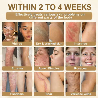Made and Shipped from USA ✨Zaevox® Biotin 10-in-1 Skin Restoration Cream 🍀
