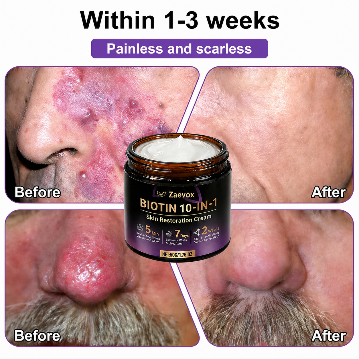 Made and Shipped from USA✨Zaevox® Biotin 10-in-1 Skin Restoration Cream🍀