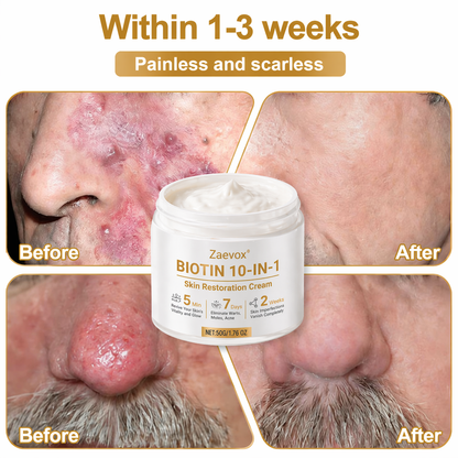 Made and Shipped from USA ✨Zaevox® Biotin 10-in-1 Skin Restoration Cream 🍀