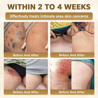 Made and Shipped from USA ✨Zaevox® Biotin 10-in-1 Skin Restoration Cream 🍀