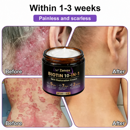 Made and Shipped from USA✨Zaevox® Biotin 10-in-1 Skin Restoration Cream🍀