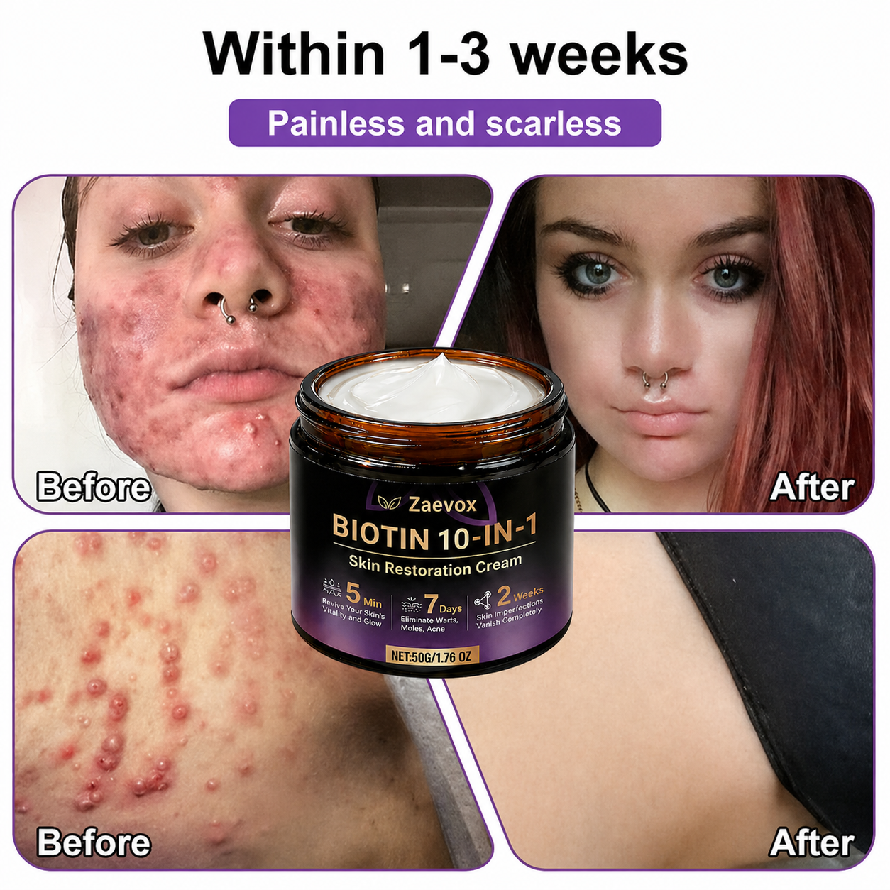 Made and Shipped from USA✨Zaevox® Biotin 10-in-1 Skin Restoration Cream🍀