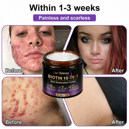 Made and Shipped from USA✨Zaevox® Biotin 10-in-1 Skin Restoration Cream🍀