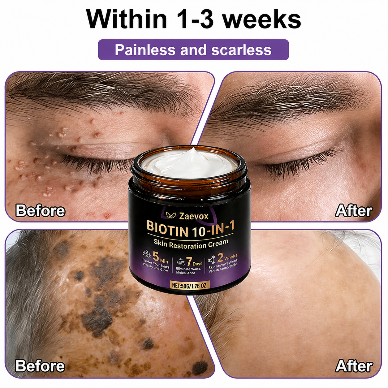Made and Shipped from USA✨Zaevox® Biotin 10-in-1 Skin Restoration Cream🍀